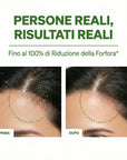 Anti-Dandruff Rebalancing Shampoo