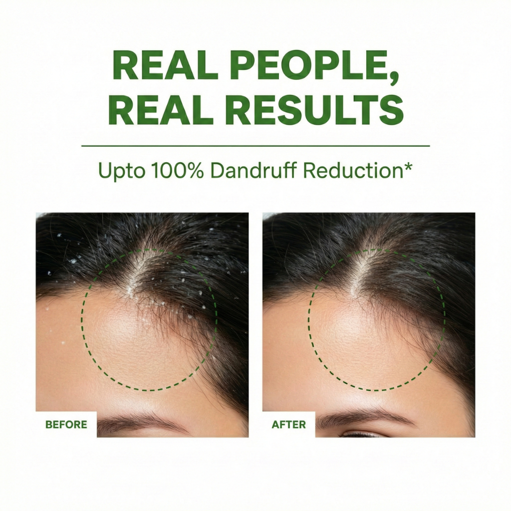 Shampoo Riequilibrante Antiforfora MOD’S Healthy Life