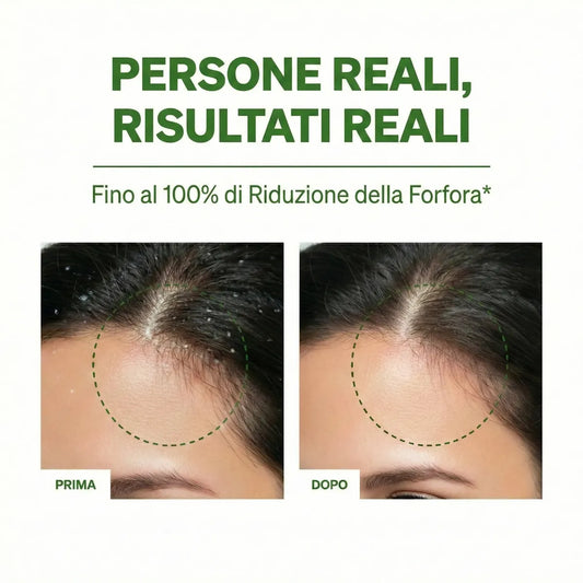 Shampoo Riequilibrante Antiforfora MOD’S Healthy Life